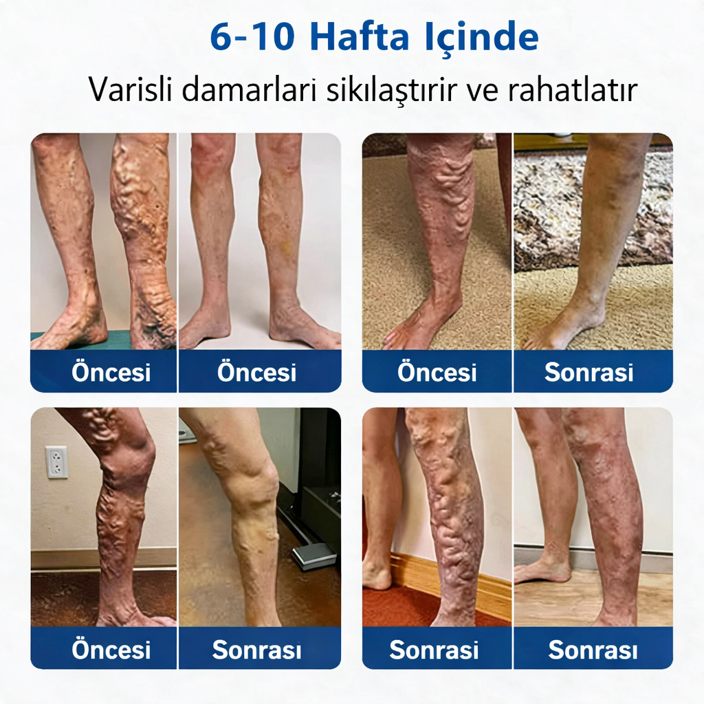 DAMAR RAHATLATICI MİKROİĞNELİ TERAPİ BANDI