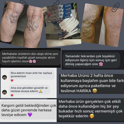 NORTHİAVE® DAMAR RAHATLATICI MİKROİĞNELİ TERAPİ BANDI